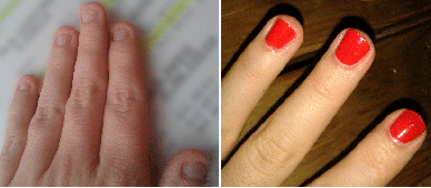 files/fotos/Vorher-Nachher.gif